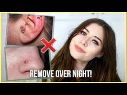 How To Get Rid Of Piercing Bumps Overnight Youtube Nose Piercing Infection Nose Piercing Bump Piercing Bump