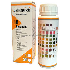 Valori medii normale in urina. Teste De Urina Cu 10 Parametri Mkd Medicale