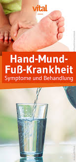 Hand Mund Fuss Krankheit Mund Fuss Krankheit Hand Mund Fuss Und Krankheit