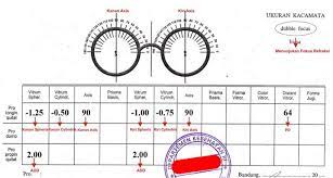 Frame kacamata wanita model baru lensa anti radiasi komputer minus. Ophthalmology Resep Kaca Mata