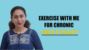 The majority of bell's palsy cases will resolve without intervention or exercise. Exercise With Me For Chronic Bell S Palsy Youtube