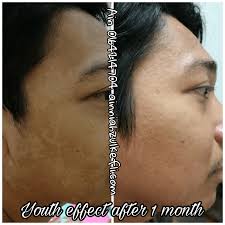 To consult, please contact or whatsapp: Skincare Untuk Kulit Sensitif Suami Sendiri Kedai Vitamin Butterworth