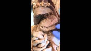 Although no membrane physically divides the. Cat Dissection Abdominal Cavity Youtube