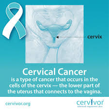 Cervical cancer may be suspected based on a pap smear, which is a routine screening test, and diagnosed with a cervical biopsy. Education Stories From Cervical Cancer Survivors Experts