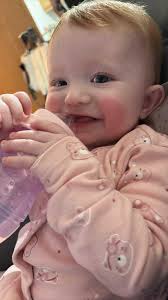 Parents Choice baby wipes causing orange discoloration?