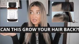 Vitamin a should be an integral part of every person's diet. Hair Regrowth Miracle Js Health Youtube
