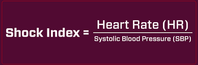 Image result for Shock Index
