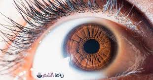 تكلفة زراعة الرموش تعرف على أسعار أشهر الدول العربية وأفضل المراكز العلاجية