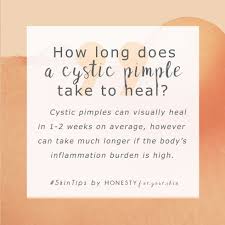 Please do your own research, and remember to. Recurring Cystic Pimple Same Spot 5 Reasons Why You Re Getting It In 2020 Cystic Pimple Pimples Acne Help