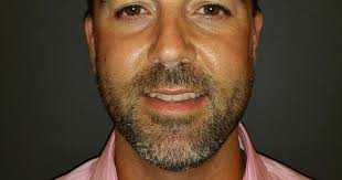 Topnotch Resort hires Gleason