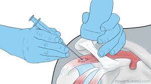 Art images kids rugs map aerial view map art. Cortisone Steroid Injections And Covid Vaccination Timing Is Everything