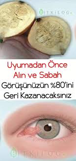 Gozluklerinizi Bir Kenara Atacaksiniz Cildi Ve Saclari Mukemmel Hale Getirecek Healthy Skin Care Healthy Skin Natural Treatments