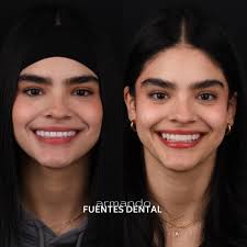 👨🏻‍⚕️ C.D. Armando