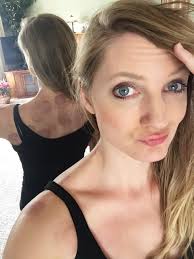 Health Benefits of Reflexology and Cupping