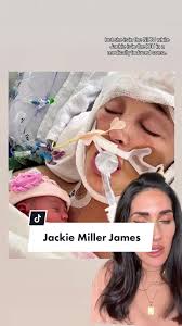 Jackie O Surgery Video