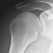 When there is severe distortion of osseous anatomy Https Www Thieme Connect De Products Ebooks Pdf 10 1055 B 0036 136584 Pdf