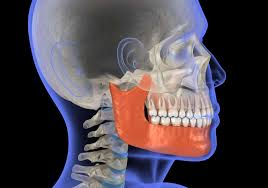 Why does my jaw ache when i wake up. Surgery For Tmj Everything You Need To Know Guide