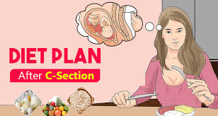 Diet Plan After C Section What To Eat What To Avoid