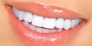 Pin On Sonrisa Perfecta