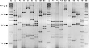 Restriction fragment length polymorphism (rflp): Can The Flic Pcr Restriction Fragment Length Polymorphism Technique Replace Classic Serotyping Methods For Characterizing The H Antigen Of Enterotoxigenic Escherichia Coli Strains Journal Of Clinical Microbiology