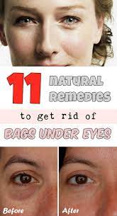 11 Natural Remedies To Get Rid Of Bags Under Eyes Beautytutorial Org Undereye Eye Bags Treatment Best Treatment For Wrinkles