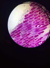 Maybe you would like to learn more about one of these? Onion Cells Under The Microscope Under Two Conditions Sucrose Solution And Water To Investigate Plasmolysed And Turgid Cells Biology A Level