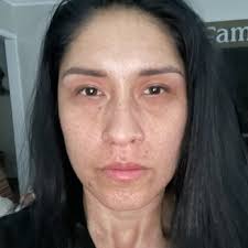 SKINPERFECT AESTHETICS -SKINCARE CLINIC