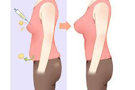 Fat transfer and insurance coverage Fat Transfer Breast Augmentation Cost In Usa Average Cost And More
