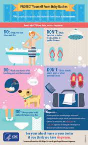 However, treatment protocols usually require about one to two weeks of treatment. Ringworm Risk Prevention Ringworm Types Of Diseases Fungal Diseases Cdc