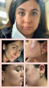 Reviews of Honest Skin Point Loma