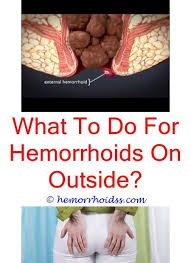 How To Naturally Relieve Hemorrhoids Getting Rid Of Hemorrhoids Bleeding Hemorrhoids Home Remedies For Hemorrhoids