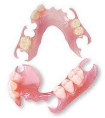 Dental Impression Kit Only For Upper Partial Dentures Online Etsy In 2020 Partial Dentures Dentures Affordable Dentures