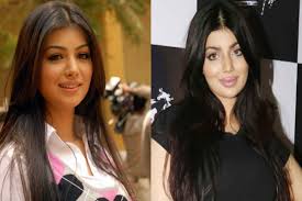 Her jawline looks a little thinner. Ayesha Takia Latest Victim Of Plastic Surgery Gone Wrong In Bollywood Actress Pictures Post Lip Job Keep Twitterati Abuzz India Com
