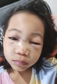 7-year-old S'pore girl allegedly flung off seat