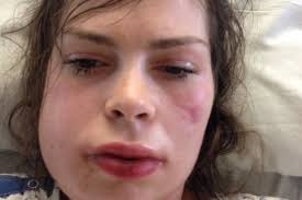 Fundraiser for Joni Stone by Bailey Stone : Marybeth