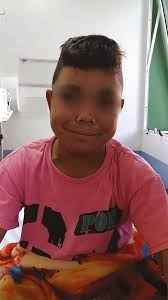 Complications of renal transplantation in patients with Ochoa urofacial  syndrome: case report