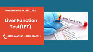 Image result for Liver Function Test