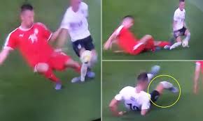 Hannes wolf will take over as his successor until the end of the season with immediate effect, while peter hermann will return as assistant coach.'in view of the. Austria U21s Hannes Wolf Suffers Horrific Leg Break Against Serbia Daily Mail Online