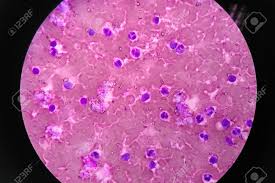 (the smaller the piece the better.) translucent means that you can see light through the specimen, but. Human Blood Cells Under Microscope View Stock Photo Picture And Royalty Free Image Image 81293492