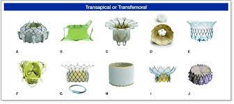Current Transcatheter Mitral Valve Replacement Devices A Download Scientific Diagram