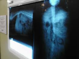 What to do if your dog eats chicken bones. Dog Swallowed Chicken Wing Www Macj Com Br