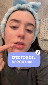 Laura De Fabrizio Acne