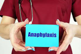 Icd 10 Codes To Report Anaphylaxis Severe Allergic Reaction