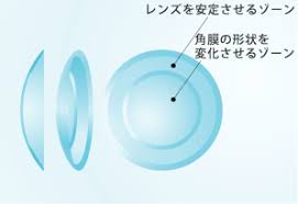 綾瀬うえむら眼科 綾瀬駅西口の眼科医院 オルソケラトロジー 白内障日帰り手術