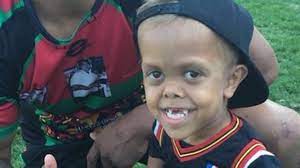 Mitchell's injury occurred when teammate jaxson paulo landed on him in a tackle and forced his left leg back. Nrl Stars Uplifting Offer To Bully Victim Observer