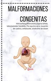 Terapia del habla para paladar hendido 1: Amazon Com Malformaciones Congenitas Hdrocefalia Anencefalia Espina Bifida Labio Paladar Hendido Pie Equino Varo Luxacion De Cadera Onfalocele Sindrome De Down Spanish Edition Ebook Cortes Ivan Kindle Store