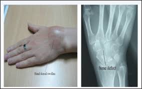 Image result for Trapezoid Bone