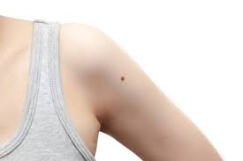 Jadi ketika kelenjar getah bening di sekitar leher, ketiak dan pangkal paha membengkak dan terasa sakit ketika di tekan, itu. Penyebab Benjolan Di Ketiak Kiri Yang Sakit Ataupun Tidak Honestdocs