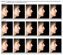 Nose Types Nose Shapes Nose Types Nose Job