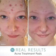 Introduction to Neora through long-term friendship